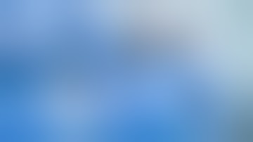 Patient Positioning, Chest Marking, and Robotic Port Placement for Robotic Mitral Valve Repair