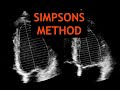 Simpsons Method: Echocardiography