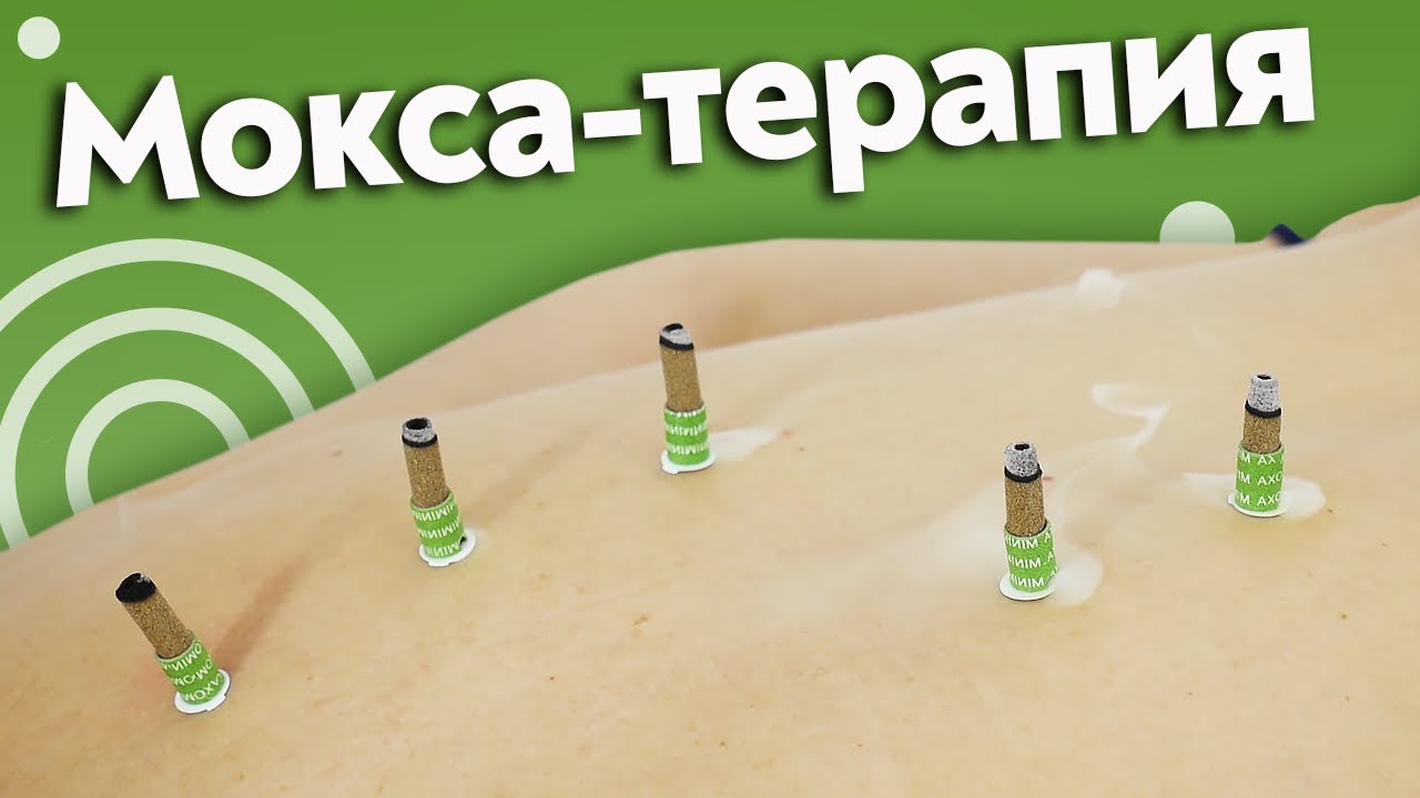 Что такое мокса-терапия? / Как работать через моксы?