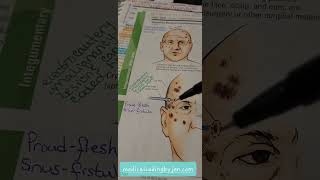 Example Integumentary Destroy vs Excision Malignancy lesions medical coding beginner certification