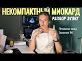 Некомпактный миокард. Летальный исход.