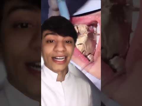 Vídeo: Encontrou Um Antigo Frogodile Com Dentes Em Locais Incomuns. - Visão Alternativa