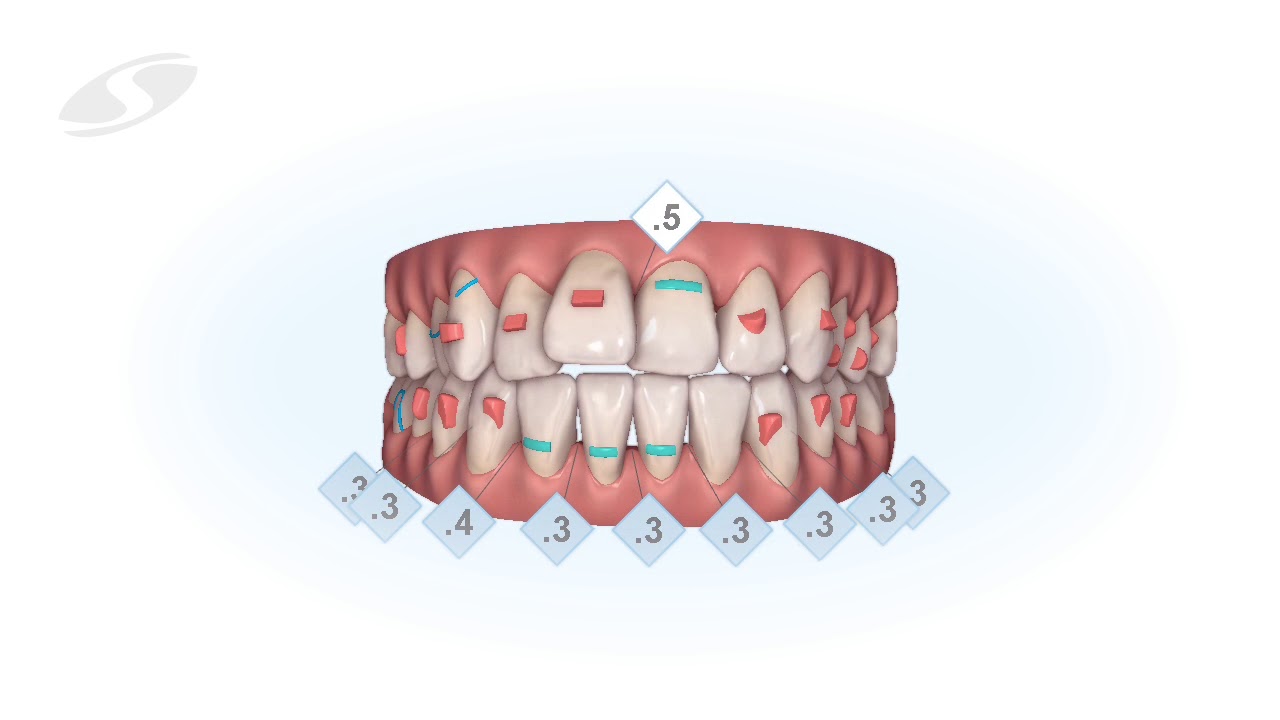 Outcome Simulator - Fortschrittsbeurteilung der Behandlung mit ...