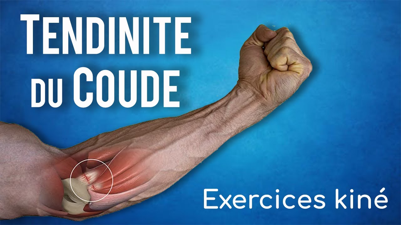 Soigner la tendinite interne du coude ( golf elbow ) : Exercices kiné 