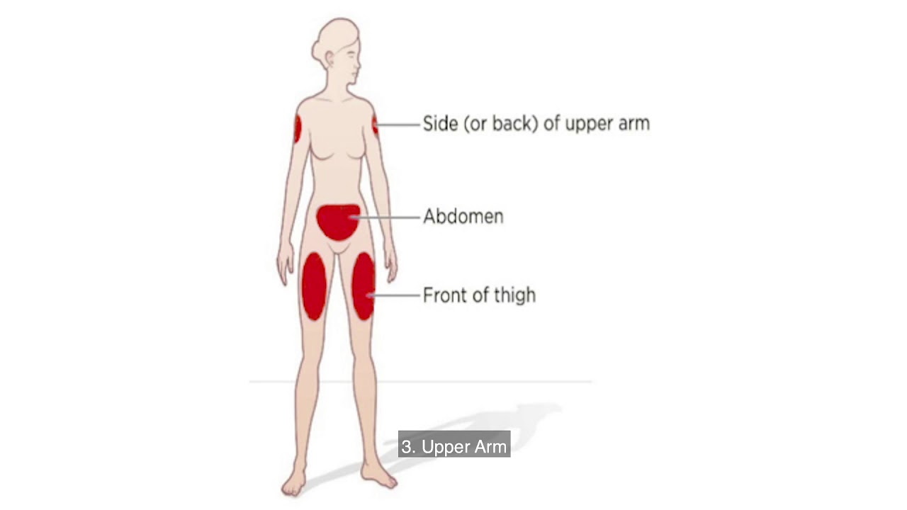 Subcutaneous Injection Sites Names Subcutaneous (SUBQ) Injection Sites