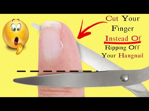 Why You Should NEVER Rip Off Your HANGNAIL