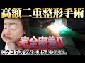 【 二重全切開 】高額二重整形手術の一部始終、全てお見せします。