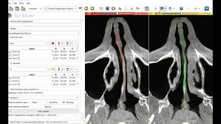 Soft tissue deformation simulation screenshot 4