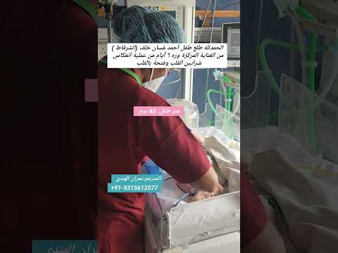 عملية ناجحة لانعكاس شرايين وفتحة بالقلب لطفل بعمر 45 يوم فقط العلاج في الهند  قلب