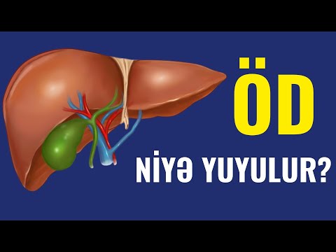 Video: Od üzüyü sadə tərifi nədir?