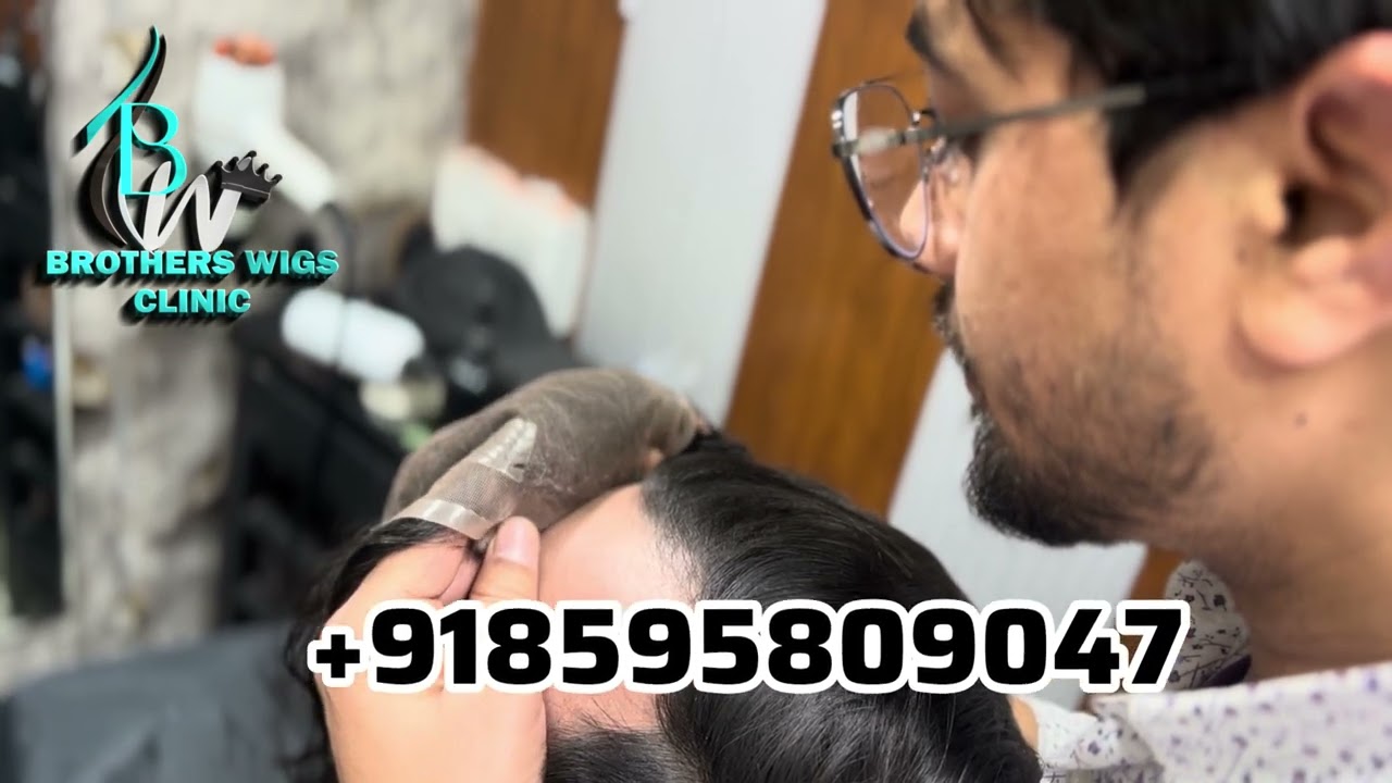 Best Hair Patch Hair Wigs for men & women In delhi 