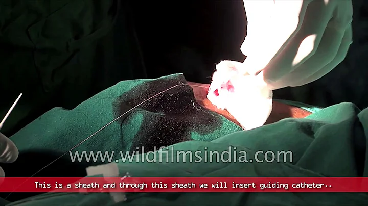 Coronary angiogram - live procedure