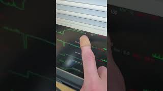Aircraft Engine Thermal Grease vs PC Thermal Paste