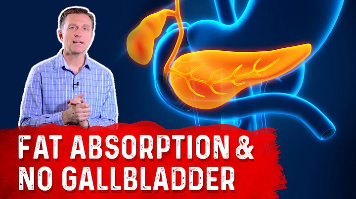 What Happens to Fat Absorption With NO Gallbladder? – Dr. Berg