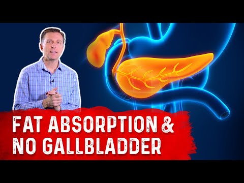 What Happens to Fat Absorption With NO Gallbladder? : Dr.Berg - YouTube