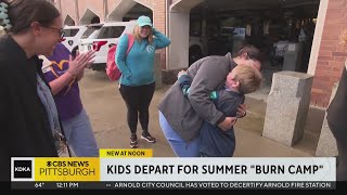 'Burn Camp' provides children with fun, life skills, and lifelong memories