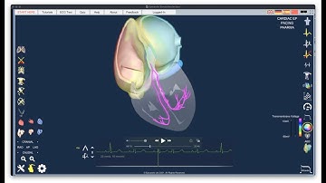 Introductory lecture on Epicardio Simulation™ - ECG