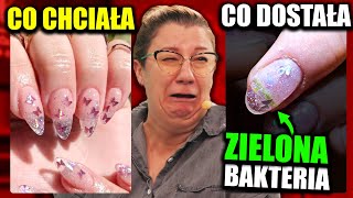 DISASTER! SHE WANTED BEAUTIFUL NAILS, SHE GOT GREEN BACTERIA!