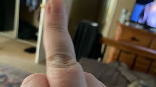 Skyrizi commercial 2023 Stink !!!