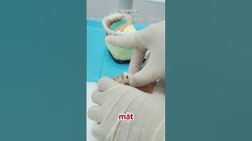 Quy Trình Phục Hình Răng Trên Implant – Các Bước Thực Hiện Tại Nha Khoa Parkview