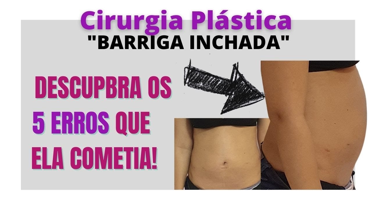 Inchaço Abdominal depois da Cirurgia Plástica: O que fazer?