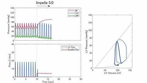 PV loop －Impella 5.0－