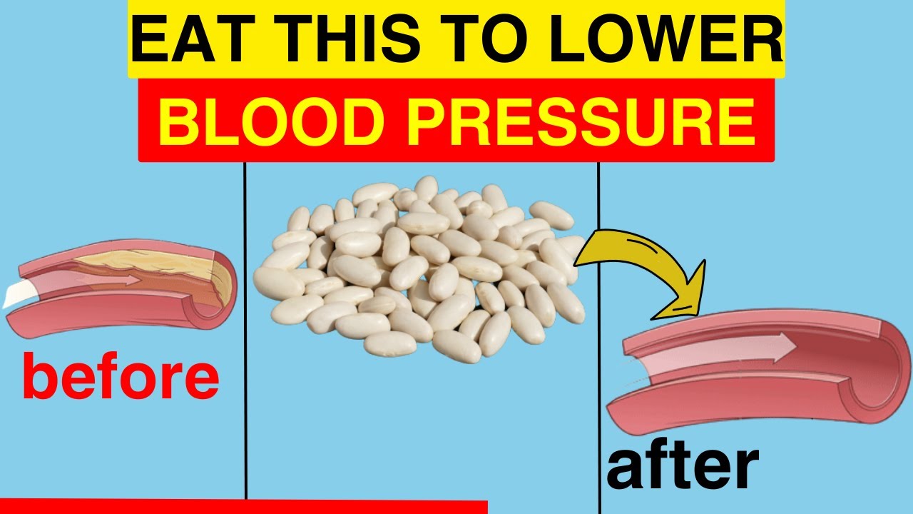 ️ 10 BEST High Potassium Foods to LOWER Your Blood Pressure Naturally