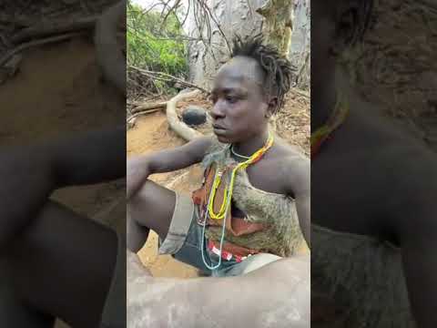 حتى الفازلين ماينفع يالله سلك خشن