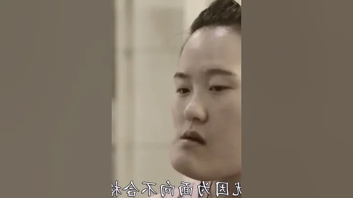 歪臉女孩：曾因長相嚇人找不到工作，「換臉」後卻拒絕百萬年薪 #000 - 天天要聞