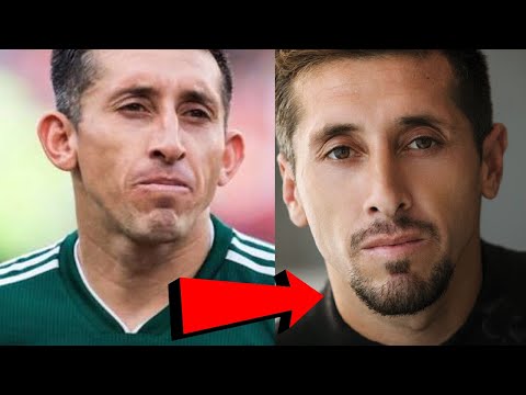 Video: Hector Herrera Has Surgery On His Face