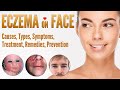 Eczema on Face Causes, Symptoms, Types, Treatment, Natural Home Remedies, Prevent | Face Dermatitis