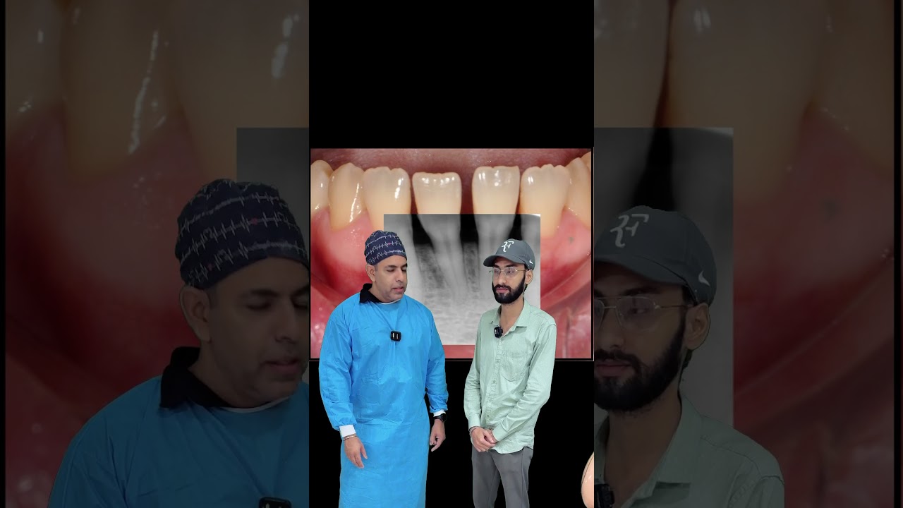 Gum recession treatment in Delhi | smile makeover Delhi