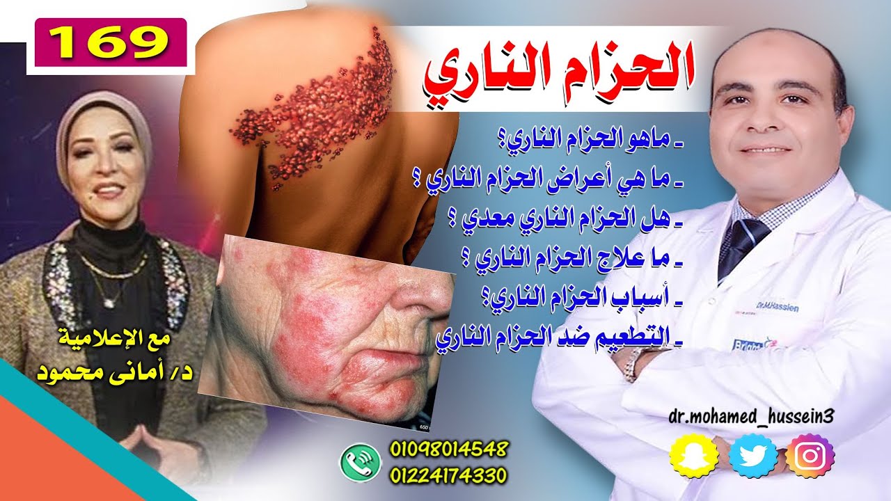 الحزام الناري - للدكتور محمد حسين - 169