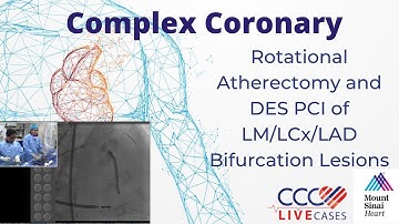Rotational Atherectomy and DES PCI of LM/LCx/LAD Bifurcation Lesions - CCC Live Nov 2016