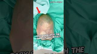 The Newborn Baby Surprised Everyone