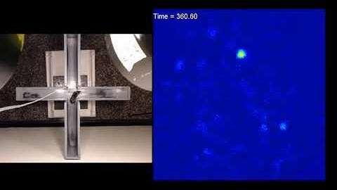 ‘Anxiety Cells’ Identified in the Brain’s Hippocampus