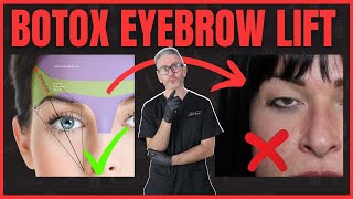 Best Botox Eyebrow Lift Injection Patterns, Avoiding Spock Brow & Ptosis