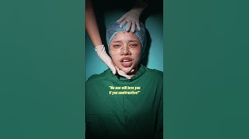 Cô gái xấu xí lột xác thành ngôi sao hạng A | An ugly girl turn to the A-list star