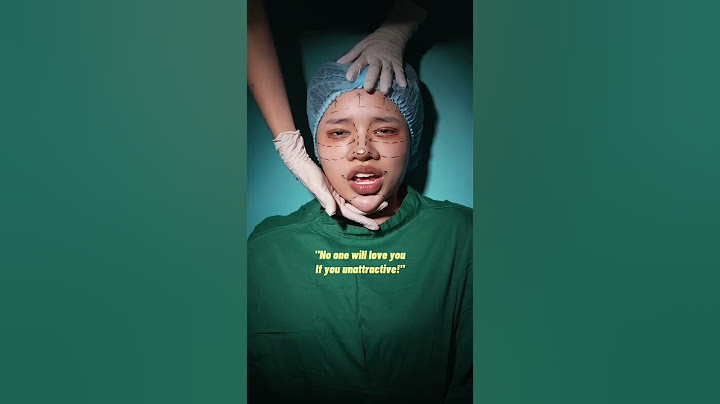 Cô gái xấu xí lột xác thành ngôi sao hạng A | An ugly girl turn to the A-list star