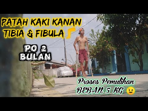 Video: Apakah fibula merupakan tulang yang menahan beban?