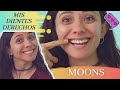 MOONS AVANCE #5 / MIS DIENTES DERECHOS / MARZO 2022