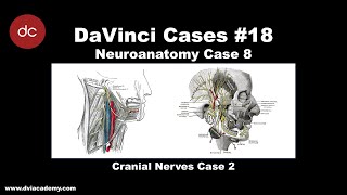 Cranial Nerves Case 2 [#DaVinciCases Neuroanatomy 8]