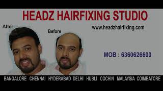 HEADZ Hair Fixing  Bangalore