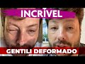 Danilo Gentili fica DEFORMADO, pensou que iria morrer, diz o apresentador do The Noite SBT