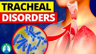 7+ Types of Tracheal Disorders | Conditions of the Trachea