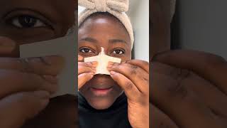 Blackhead remover reveals surprising results! #skintok