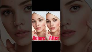 Remove Pimples in 30 Seconds photoediting picsart edit photoshop