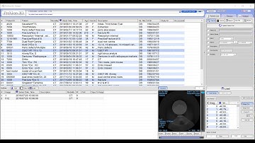 PreXion Training Tips: Copy Study PrexViewer to Disc or USB