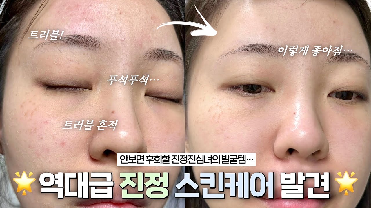 YouTube thumbnail, You need 윤이든