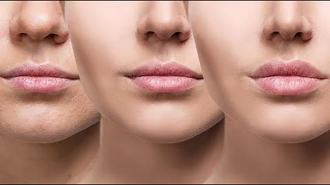 ¿Qué es el Botox lip flip?